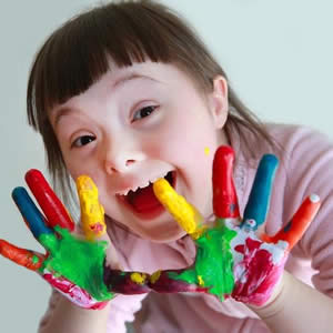 sindrome down em maringá fisioterapeuta maringa fisioterapia em maringa